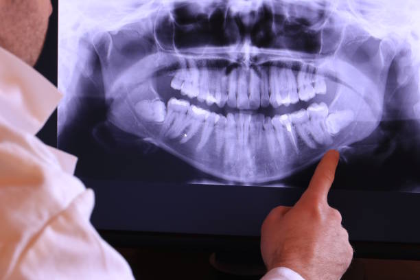 Best Holiday Emergency Dentist in Marshall, TX