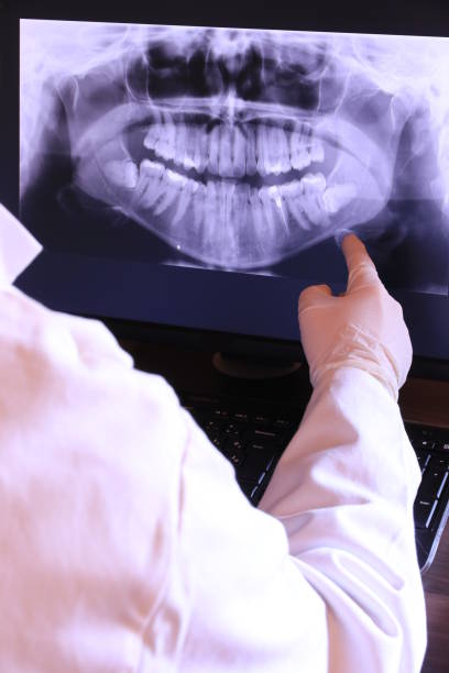 Best Emergency Root Canal Treatment in Marshall, TX