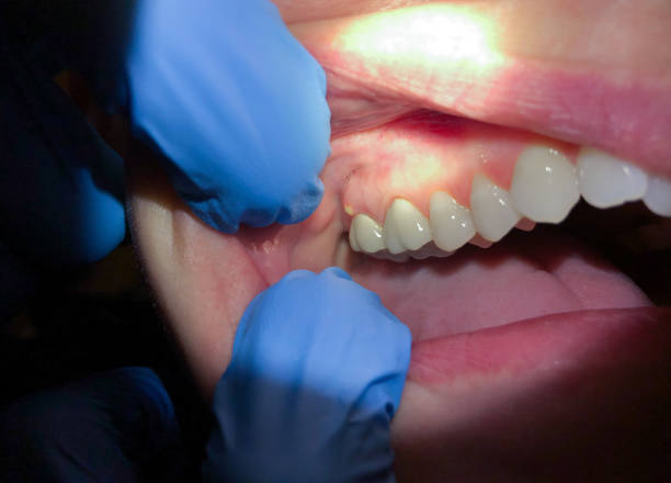 Best Orthodontic Emergency Dentist in Marshall, TX