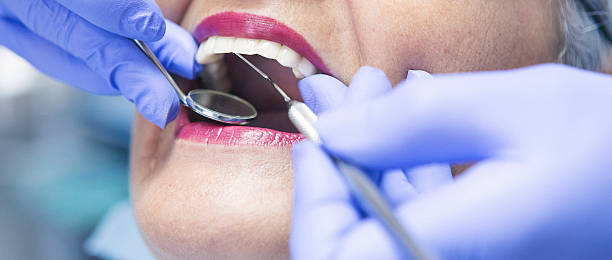 Best Emergency Dental Extractions in Marshall, TX